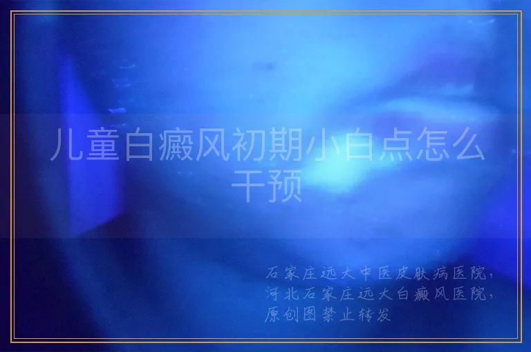 儿童白癜风初期小白点怎么干预