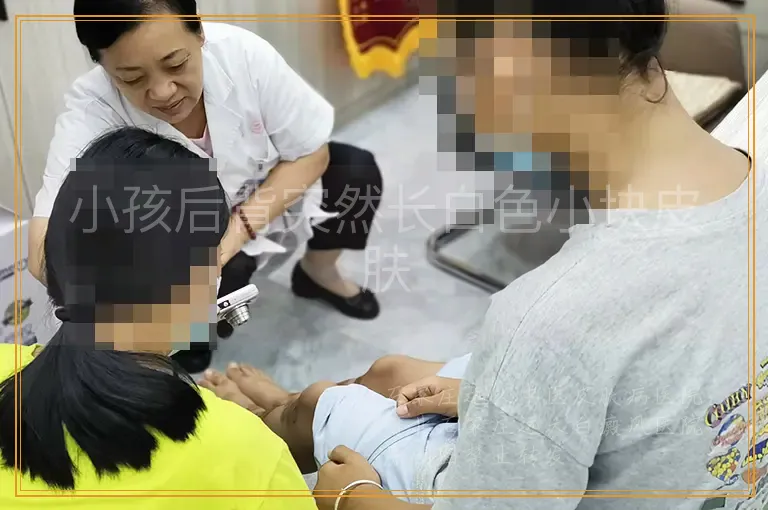 小孩后背突然长白色小块皮肤
