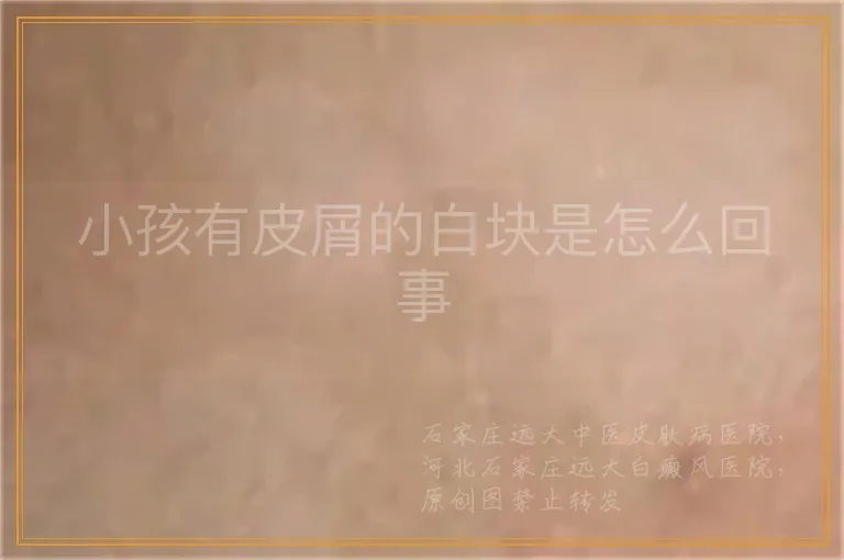 小孩有皮屑的白块是怎么回事