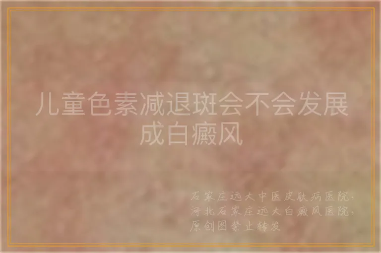 儿童色素减退斑会不会发展成白癜风