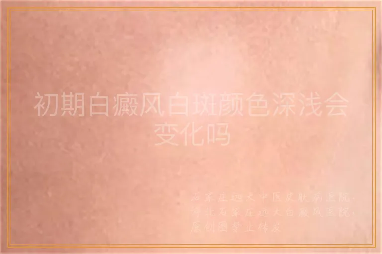 初期白癜风白斑颜色深浅会变化吗