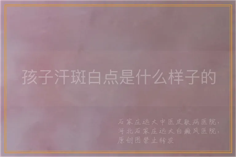 孩子汗斑白点是什么样子的