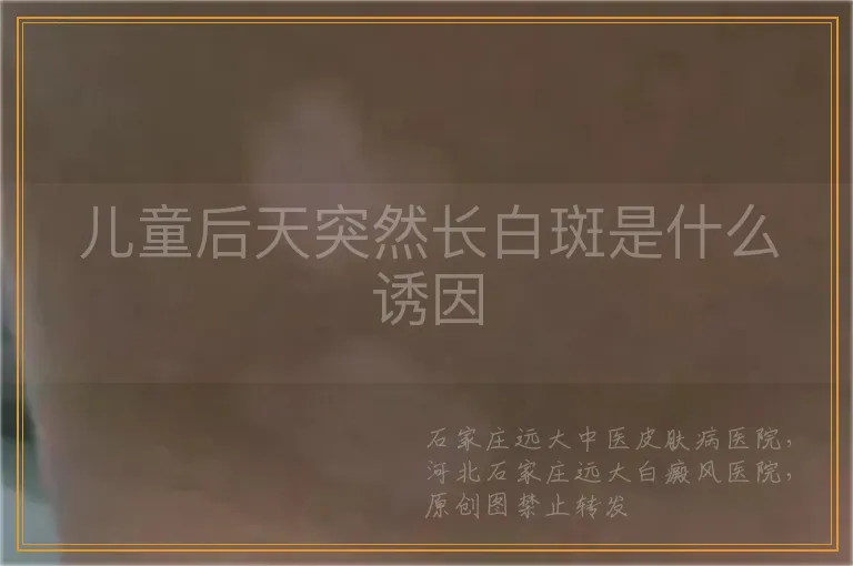 儿童后天突然长白斑是什么诱因