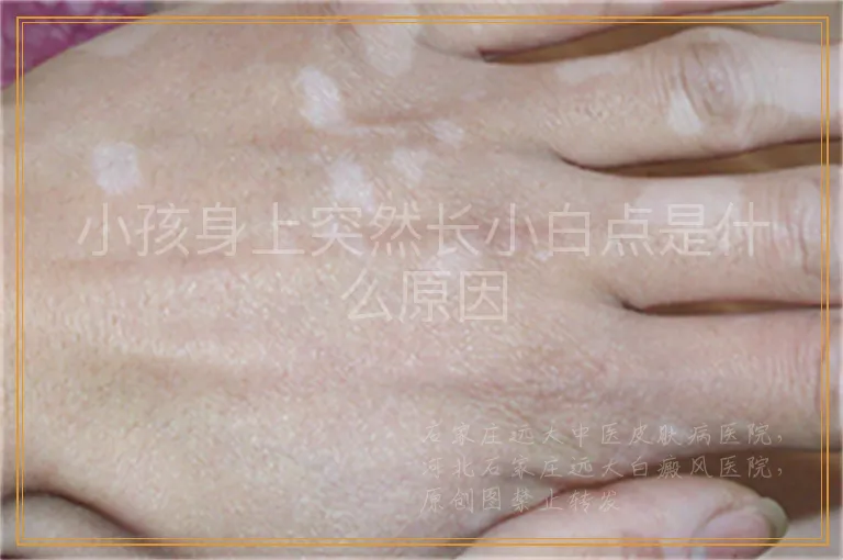 小孩身上突然长小白点是什么原因