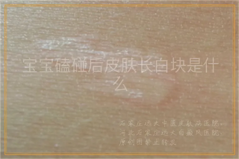 宝宝磕碰后皮肤长白块是什么