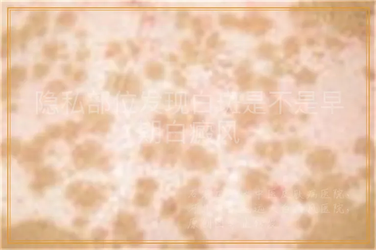 隐私部位发现白斑是不是早期白癜风