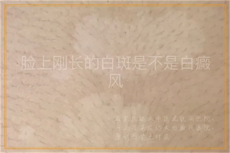 脸上刚长的白斑是不是白癜风