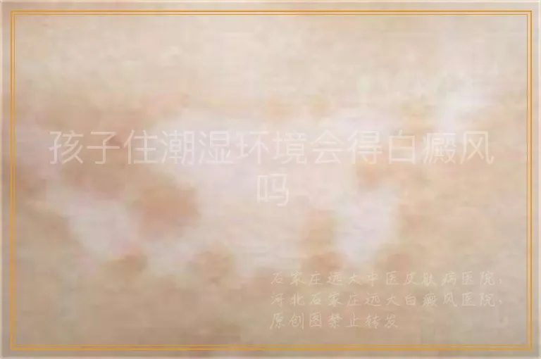 孩子住潮湿环境会得白癜风吗