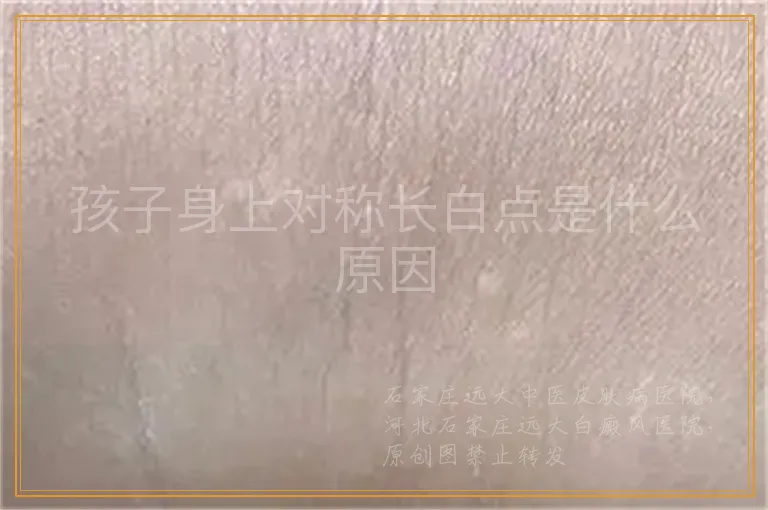 孩子身上对称长白点是什么原因