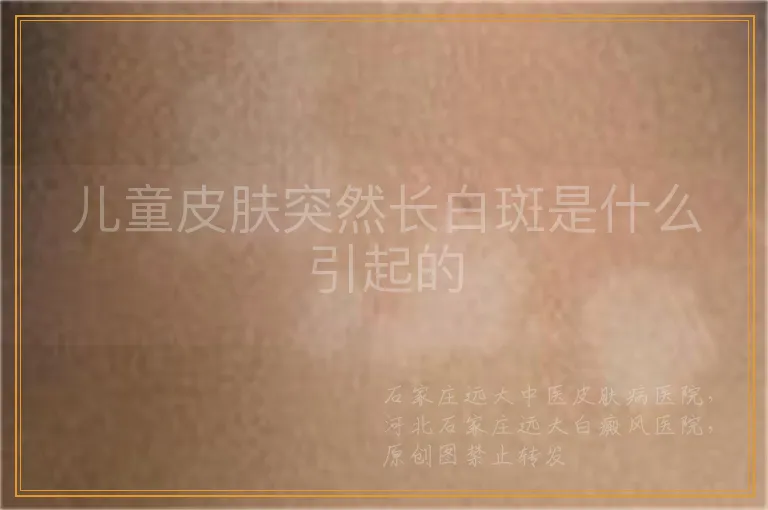 儿童皮肤突然长白斑是什么引起的