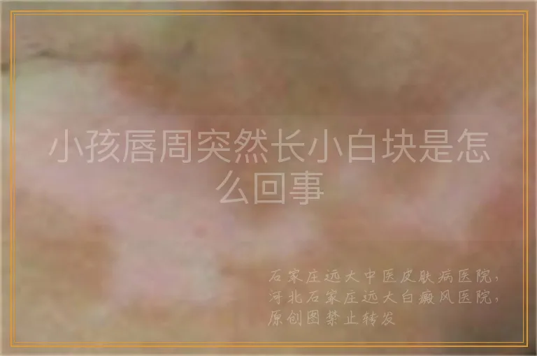 小孩唇周突然长小白块是怎么回事