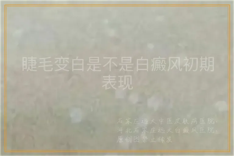 睫毛变白是不是白癜风初期表现
