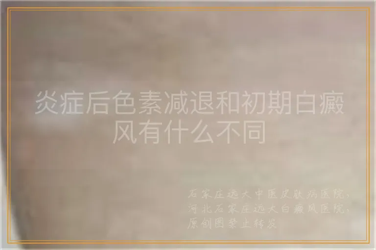炎症后色素减退和初期白癜风有什么不同