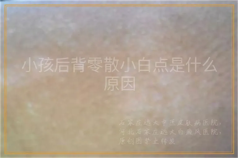 小孩后背零散小白点是什么原因