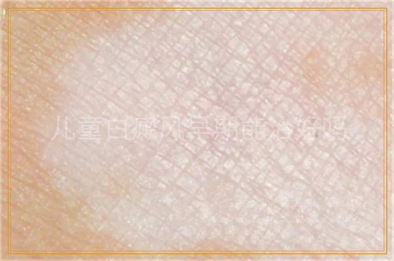 儿童白癜风早期能治好吗