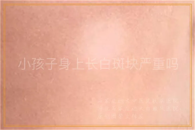 小孩子身上长白斑块严重吗