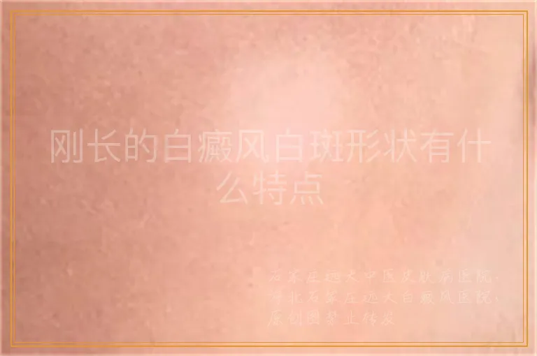 刚长的白癜风白斑形状有什么特点