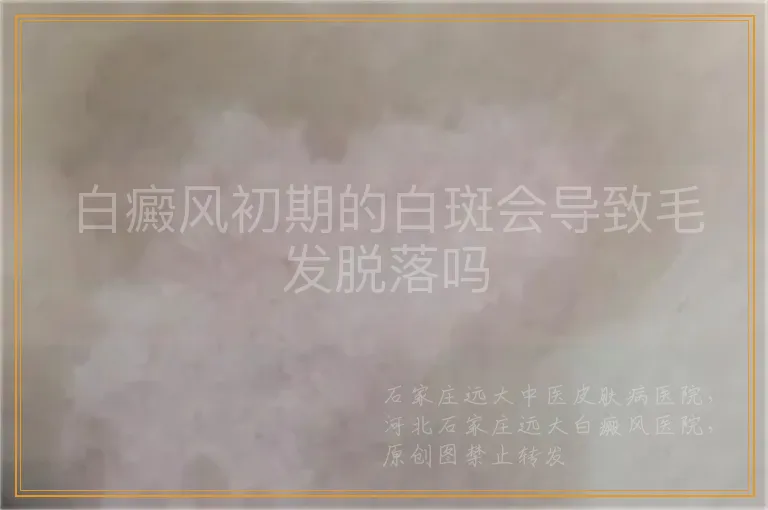 白癜风初期的白斑会导致毛发脱落吗