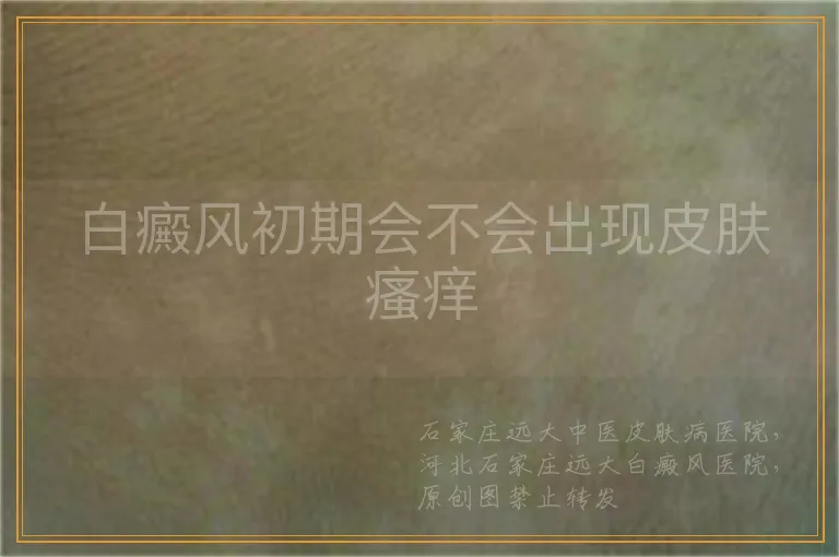 白癜风初期会不会出现皮肤瘙痒