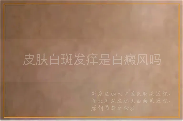 皮肤白斑发痒是白癜风吗