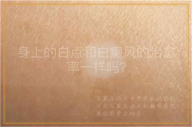 身上的白点和白癜风的治愈率一样吗？