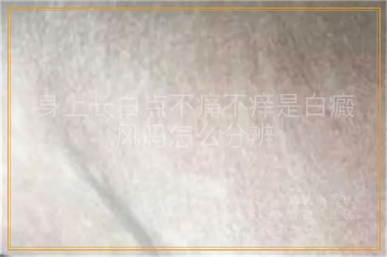 身上长白点不痛不痒是白癜风吗怎么分辨