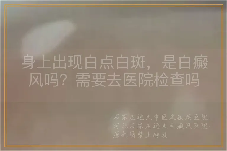身上出现白点白斑，是白癜风吗？需要去医院检查吗