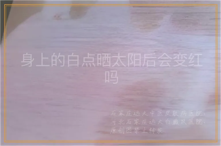 身上的白点晒太阳后会变红吗