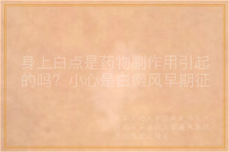身上白点是药物副作用引起的吗？小心是白癜风早期征兆