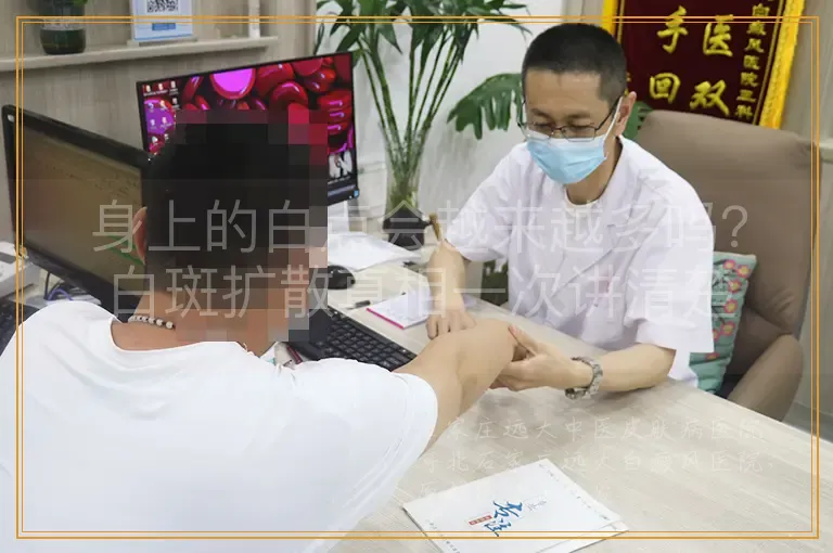 身上的白点会越来越多吗？白斑扩散真相一次讲清楚