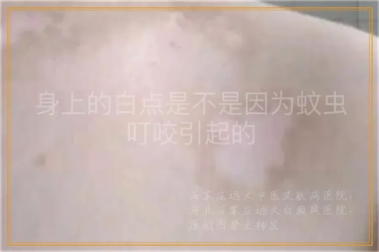 身上的白点是不是因为蚊虫叮咬引起的