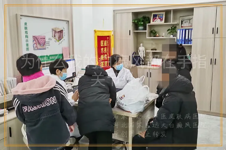 为什么我的白癜风都在手指关节处