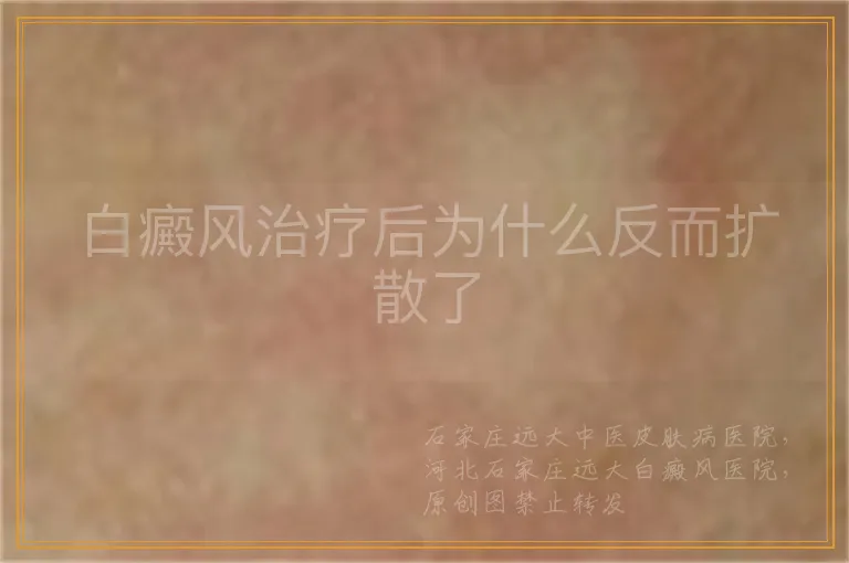白癜风治疗后为什么反而扩散了
