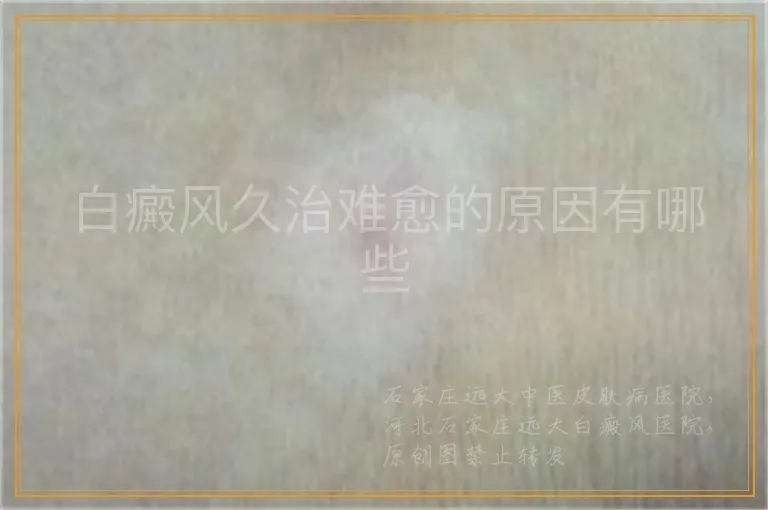 白癜风久治难愈的原因有哪些