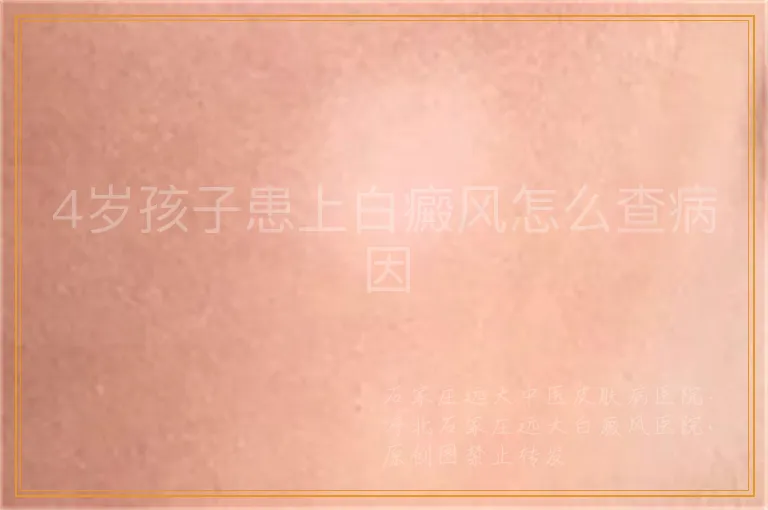 4岁孩子患上白癜风怎么查病因