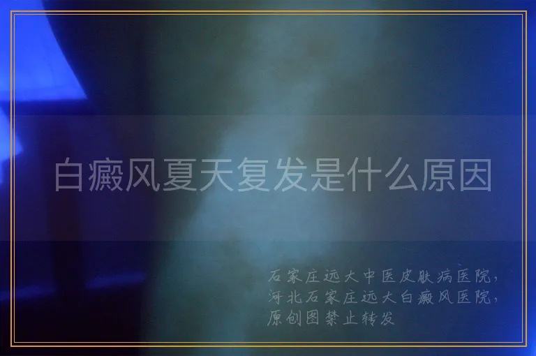 白癜风夏天复发是什么原因