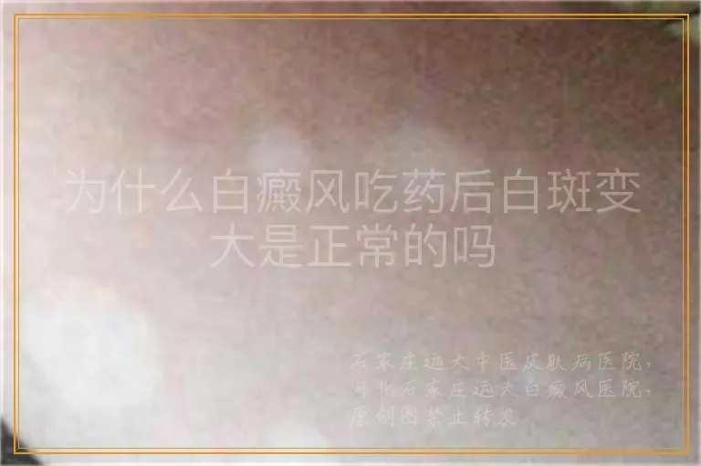 为什么白癜风吃药后白斑变大是正常的吗