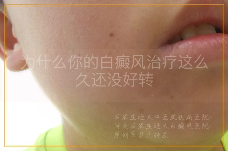 为什么你的白癜风治疗这么久还没好转