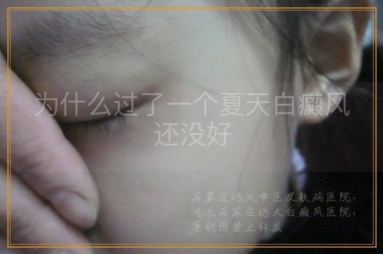 为什么过了一个夏天白癜风还没好