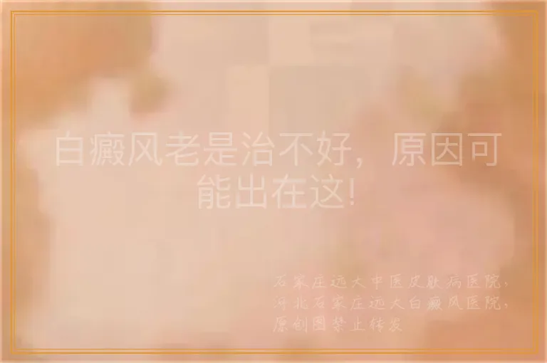 白癜风老是治不好，原因可能出在这!