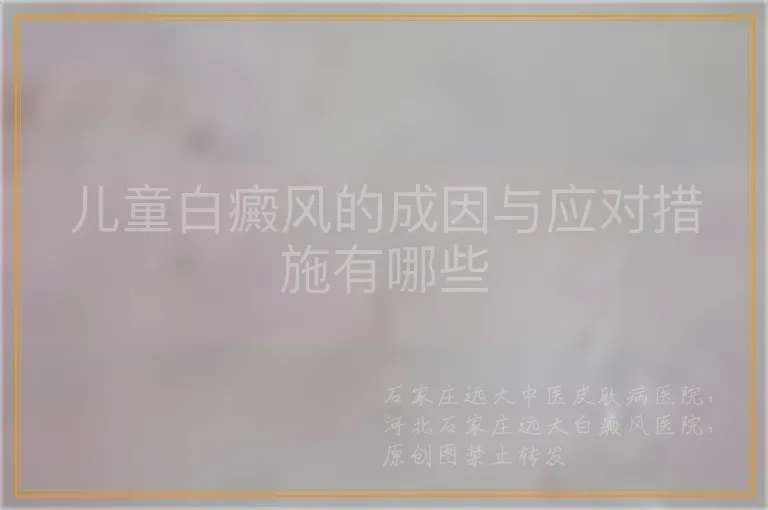 儿童白癜风的成因与应对措施有哪些