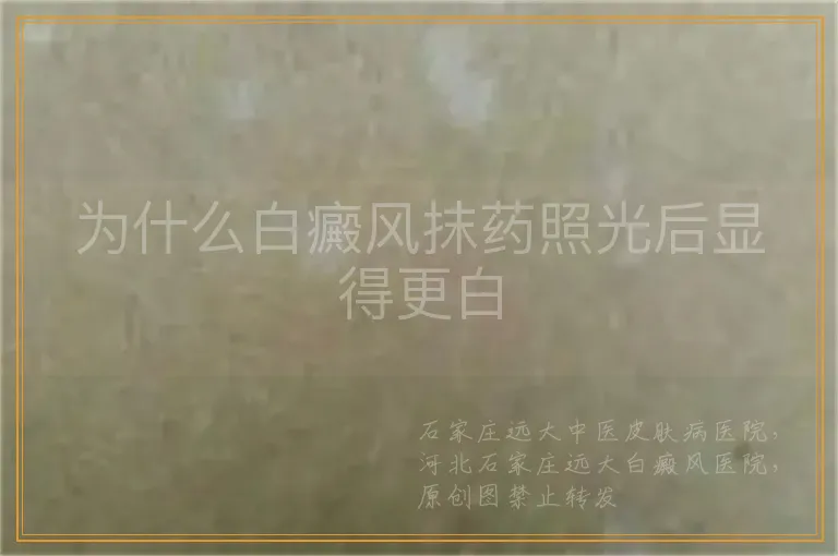 为什么白癜风抹药照光后显得更白