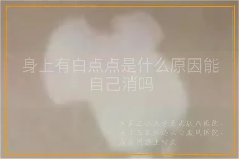 身上有白点点是什么原因能自己消吗