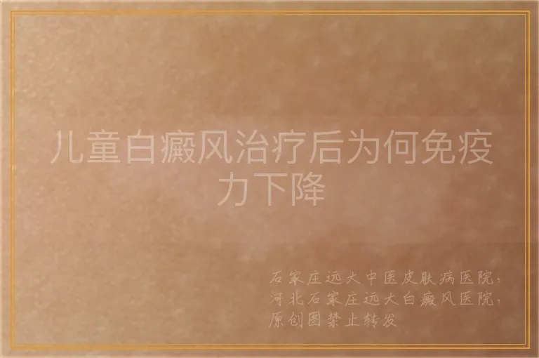 儿童白癜风治疗后为何免疫力下降
