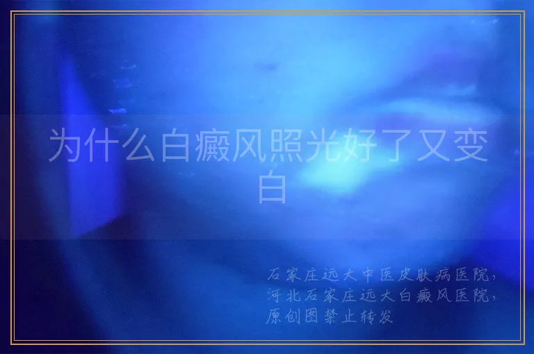 为什么白癜风照光好了又变白