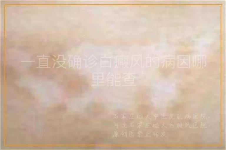 一直没确诊白癜风的病因哪里能查