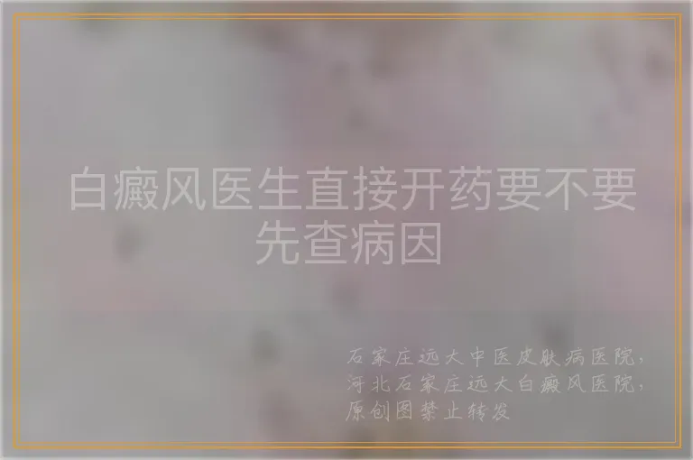 白癜风医生直接开药要不要先查病因