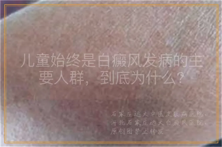 儿童始终是白癜风发病的主要人群，到底为什么?