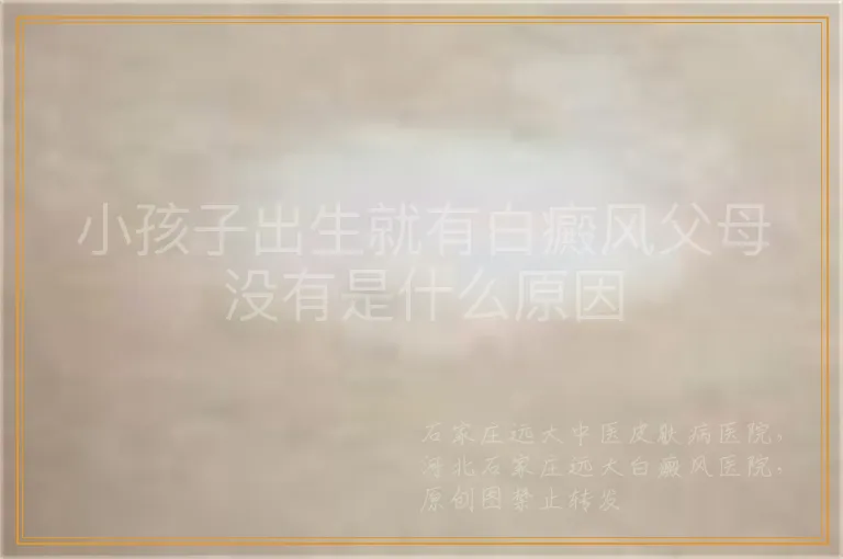 小孩子出生就有白癜风父母没有是什么原因
