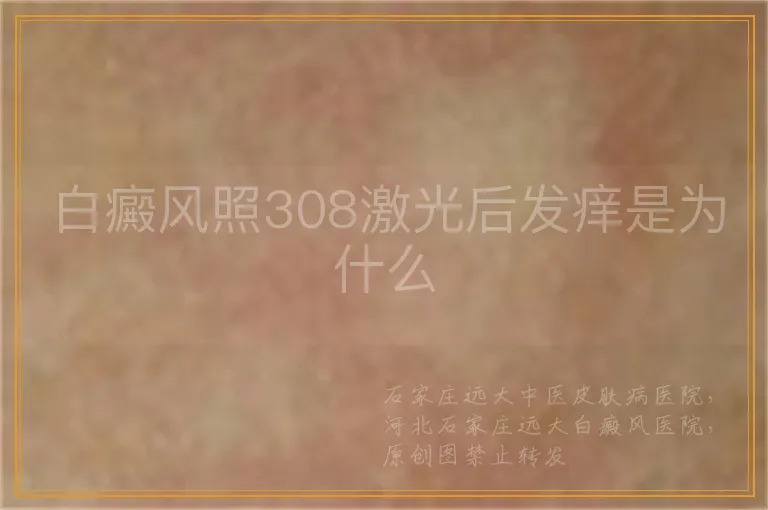 白癜风照308激光后发痒是为什么
